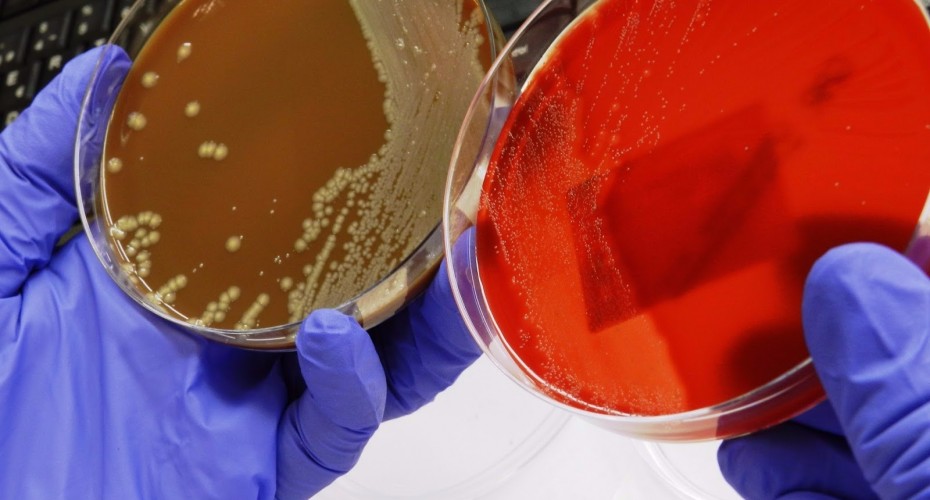 Lectura de cultius. Laboratori de Referència de Catalunya